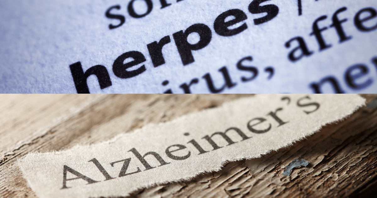 Unveiling the Hidden Link Between Herpes and Alzheimers
